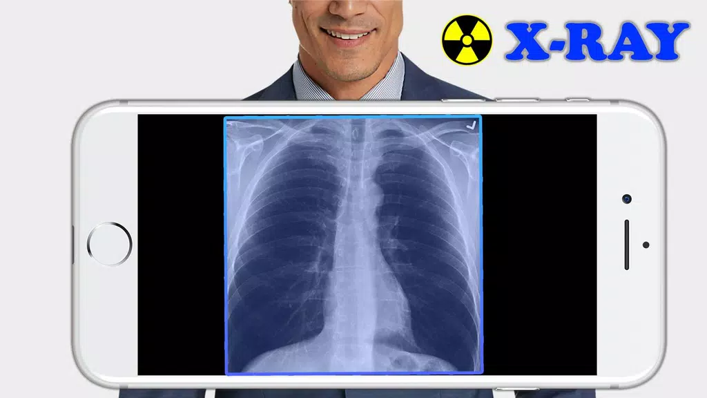 X-Ray Filter Photo 스크린샷 1