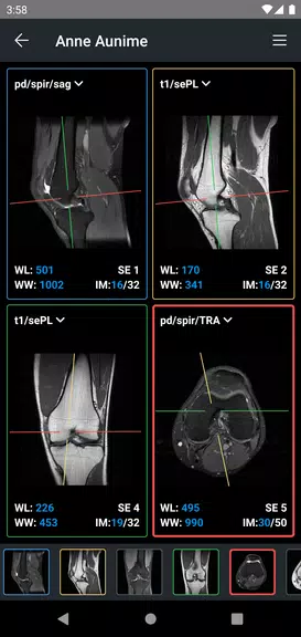 IDV - IMAIOS DICOM Viewer ภาพหน้าจอ 3