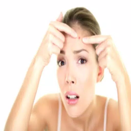 Get Rid of Acne  (Guide) Captura de tela 1