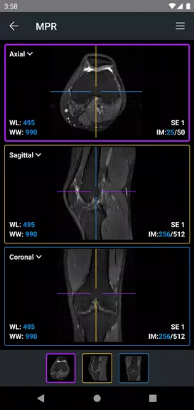 IDV - IMAIOS DICOM Viewer ภาพหน้าจอ 4