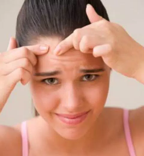 guide to Get rid of Acne Tangkapan skrin 1
