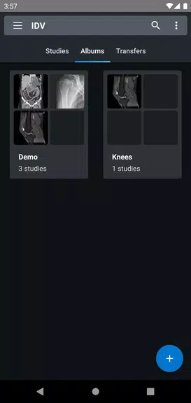 IDV - IMAIOS DICOM Viewer ภาพหน้าจอ 2