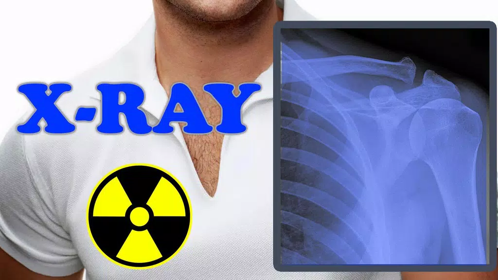X-Ray Filter Photo 스크린샷 3